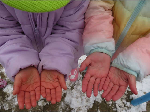 手がまっかになっちゃった～